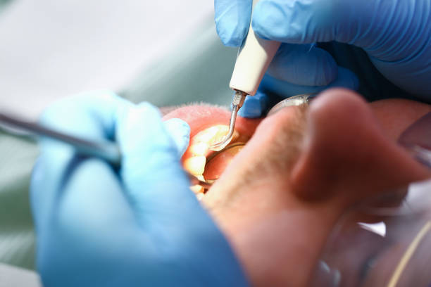 Best Pediatric Emergency Dentist in Ferron, UT